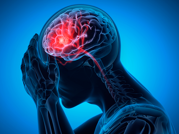 ¿Qué es la migraña?